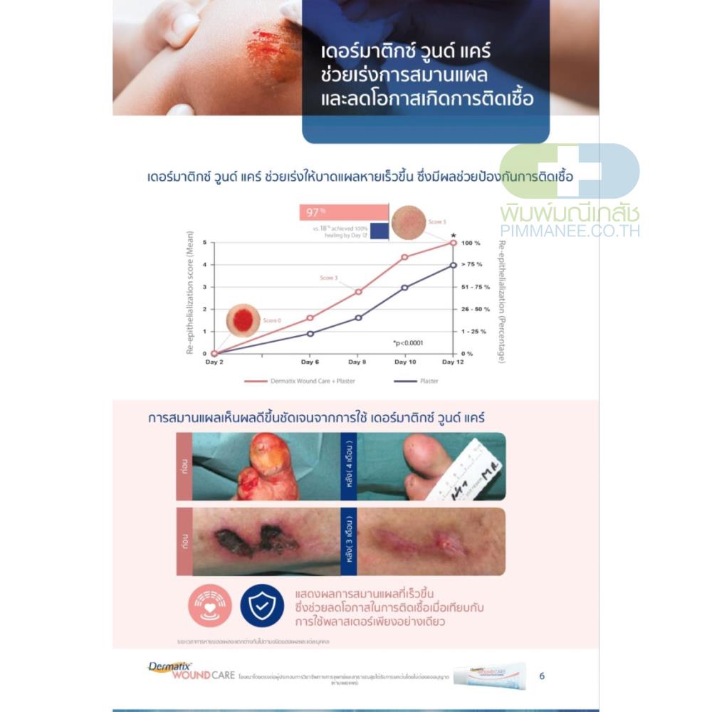 Dermatix Wound Care 20g เดอร์มาติกซ์ วูนด์ แคร์ 20 กรัม ไฮโดรเจลสมานแผล